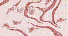 Dense irregular connective tissue